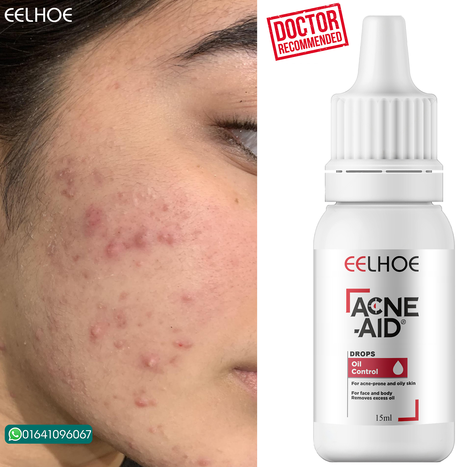 Picture of EELHOE Acne Aid Dr. Advice No.11 Acne Drops 15ml Doctor Recommended