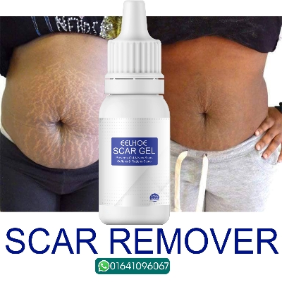 Picture of EELHOE Scar Removal Cream Gel Burn Surgical Scar Cesarean Scar Repairing Stretch Marks Pigmentation Corrector