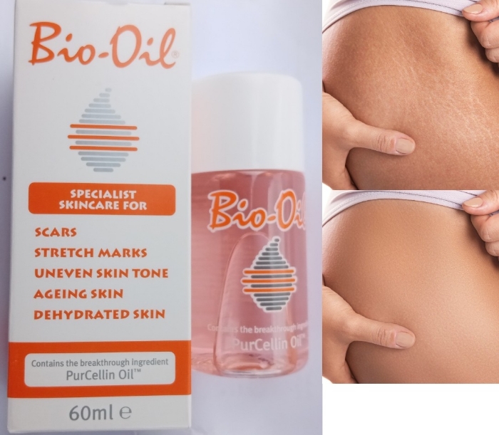 Picture of Bio_Oil Skin care body oil 60ml