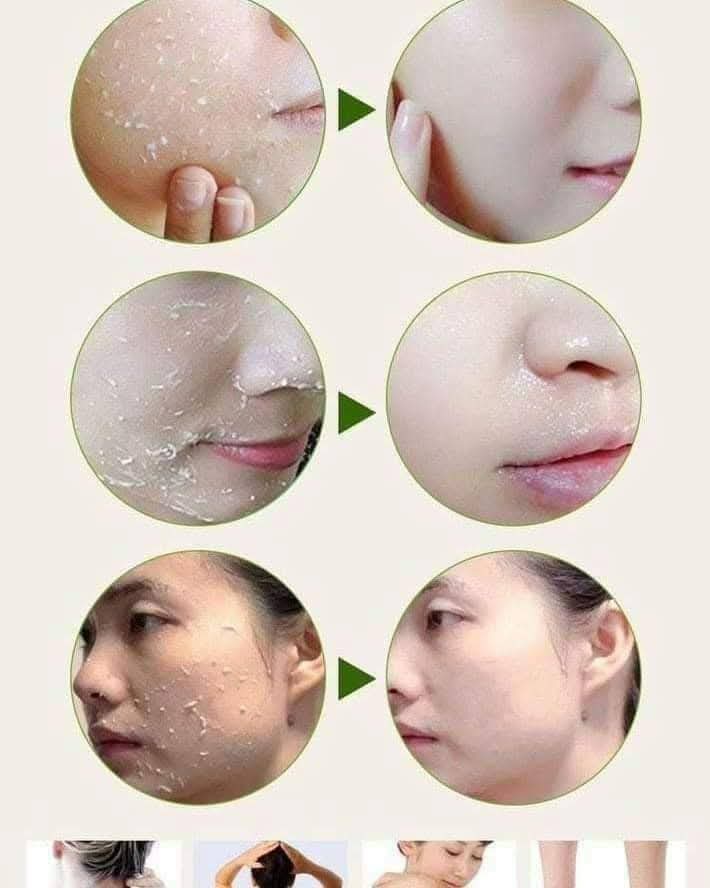 Picture of Tomato peeling Gel 320ml