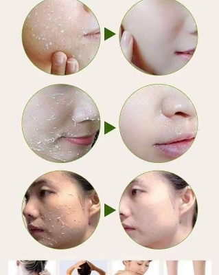 Picture of Tomato peeling Gel 320ml