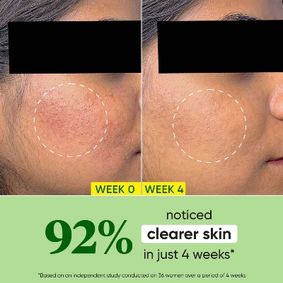 Picture of Dot and Key Cica + Niacinamide Oil Free Moisturizer 15ml