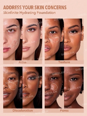 Picture of SHEGLAM Skinfinite Hydrating Foundation Flawless Dewy Foundation Hydrating Coverage Invisible Pore Concealer Pore-less Non-Greasy Lightweight Natural Soft Liquid Foundation-Acorn