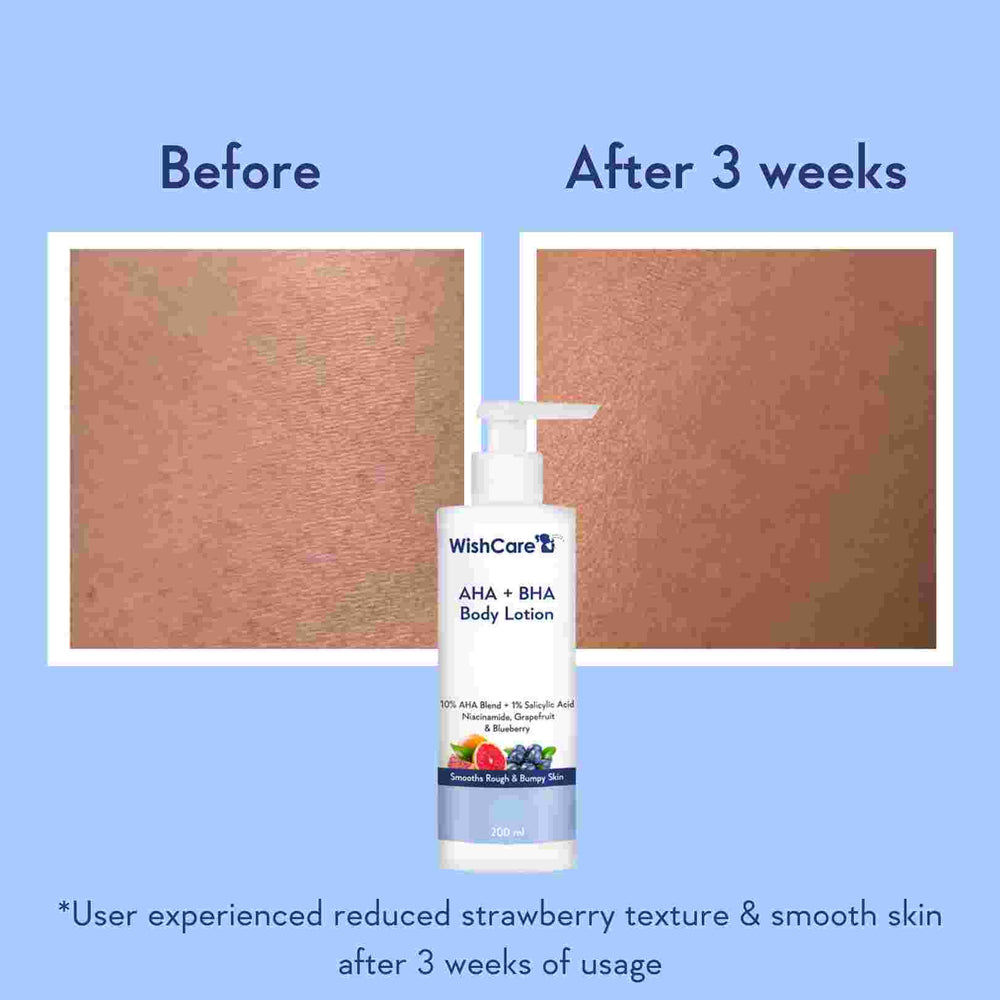 Picture of WishCare AHA + BHA Body Lotion | 200ml