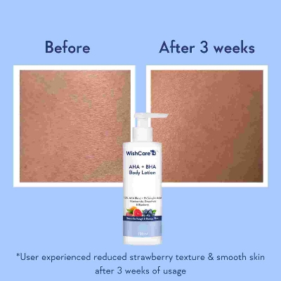 Picture of WishCare AHA + BHA Body Lotion | 200ml