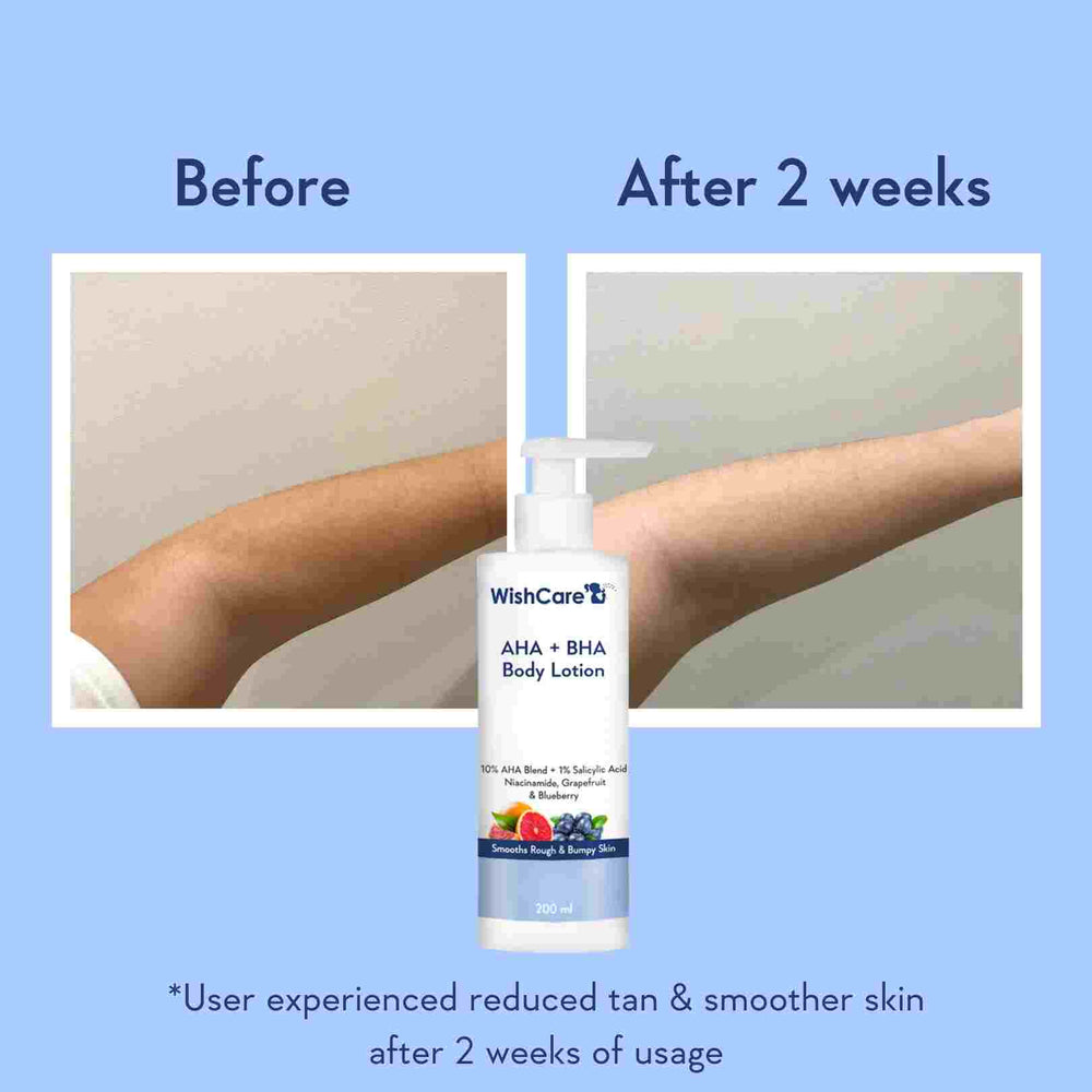 Picture of WishCare AHA + BHA Body Lotion | 200ml