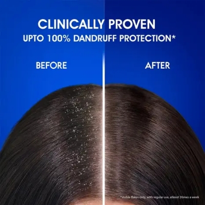 Picture of Head & Shoulders Smooth and Silky Anti-Dandruff Paraben Free Shampoo 1L