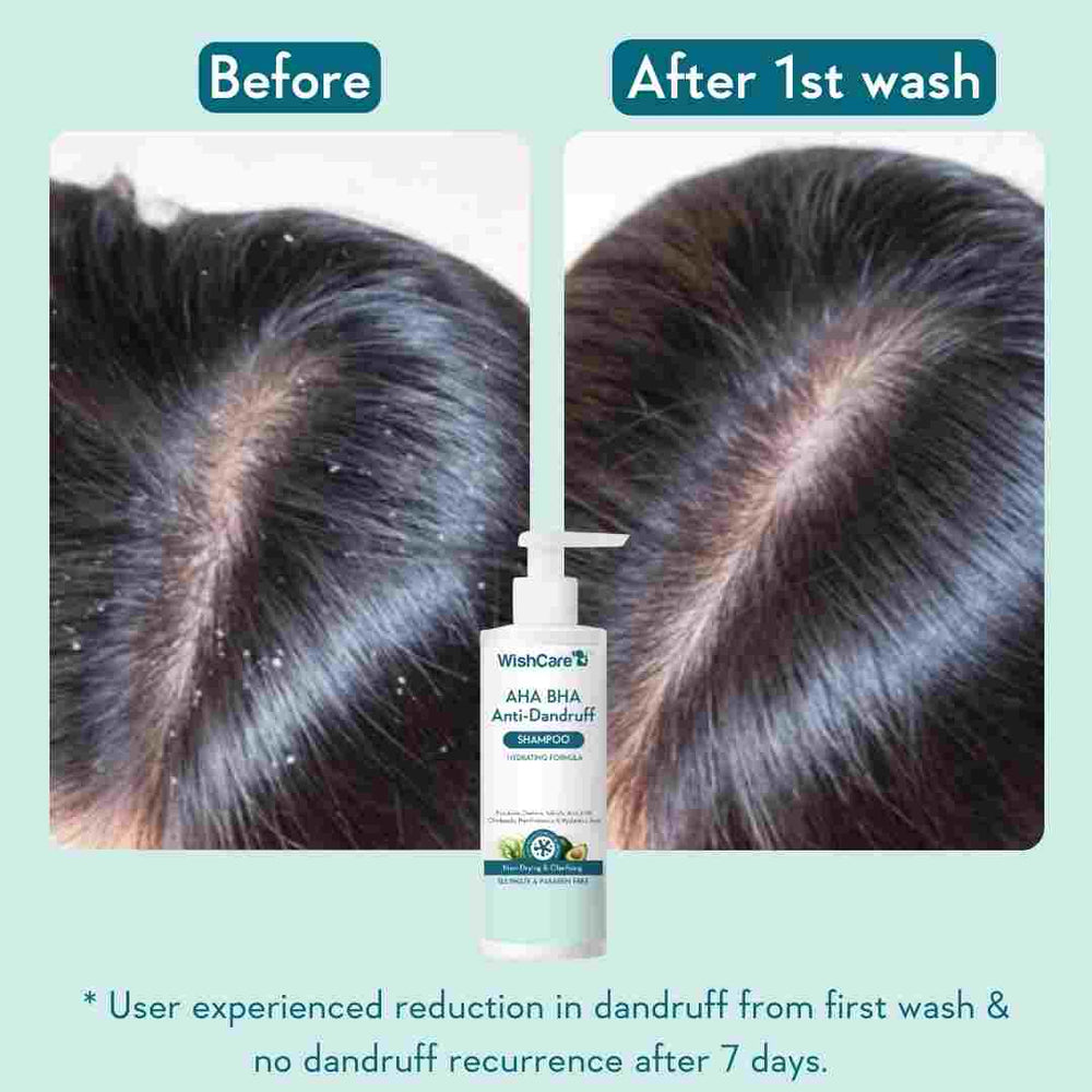 Picture of WishCare AHA BHA Anti-Dandruff Shampoo 250ml