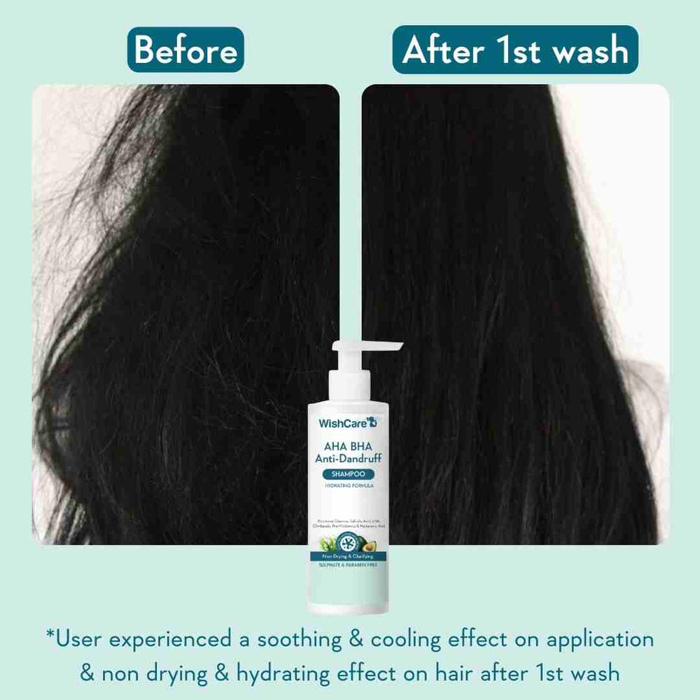 Picture of WishCare AHA BHA Anti-Dandruff Shampoo 250ml