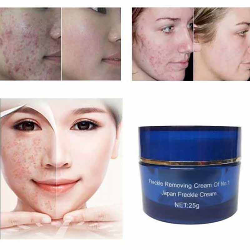 Picture of Anti Freckle Spot Out Cream
