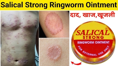 Picture of SALICAL STRONG Ointment 15g