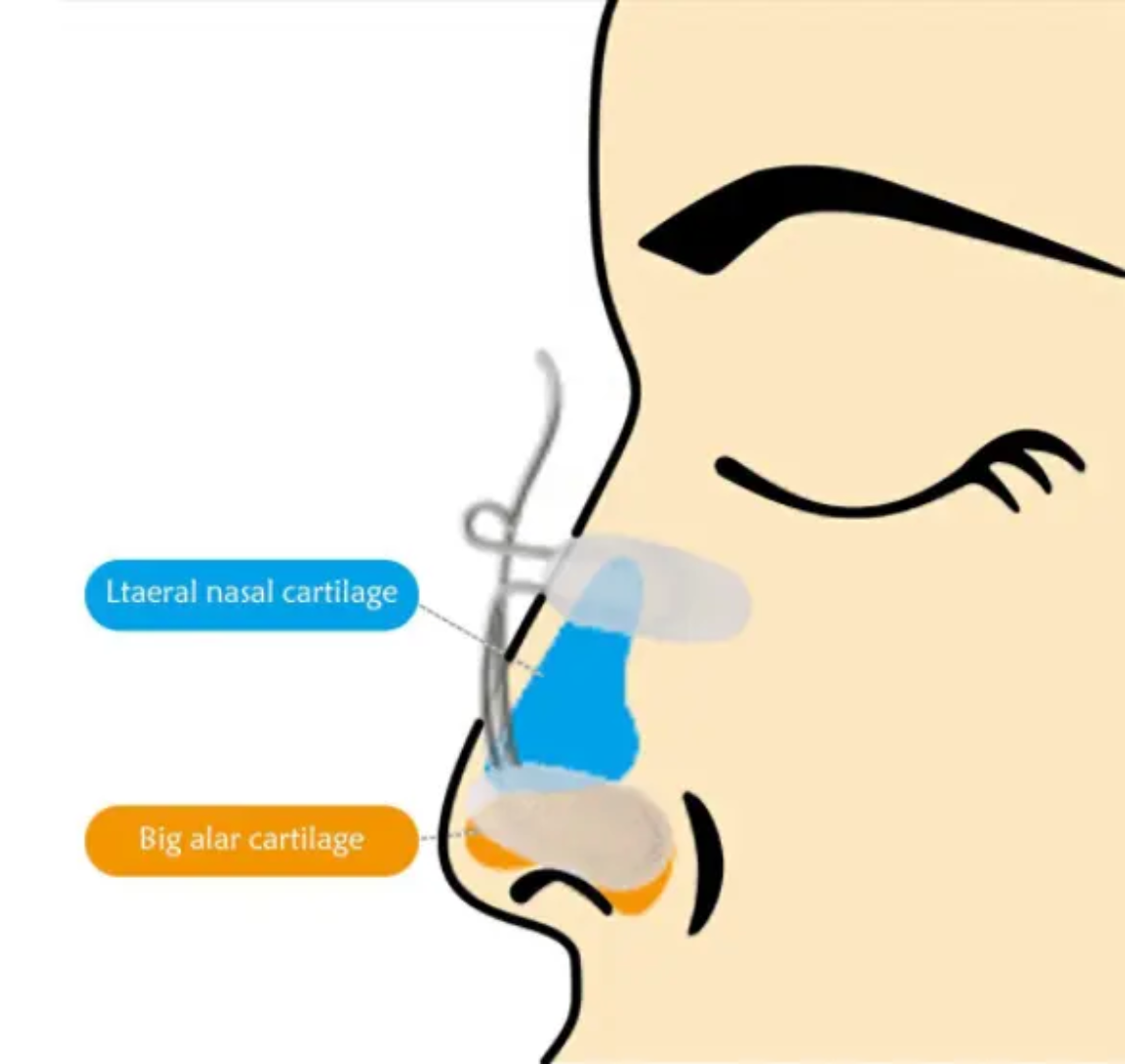 Picture of Nose Up Shaping Shaper Lifting Clip Health Massager Care Bridge Straightening Beauty Nose Shaper Beauty Care