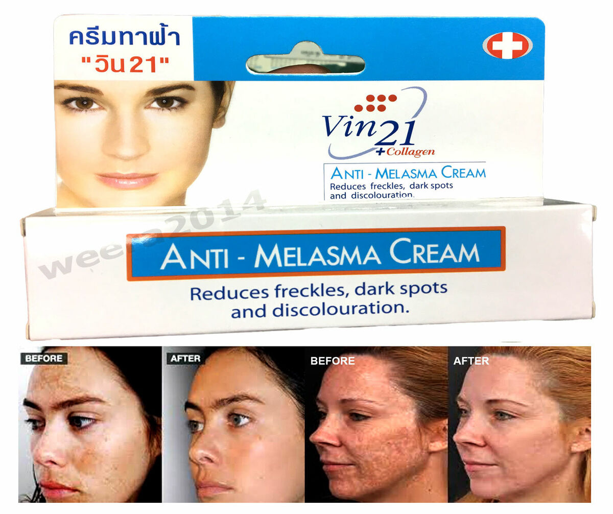 Picture of VINCERE ANTI-MELASMA CREAM - Help to fade freckles dark spots discoloration -15ml