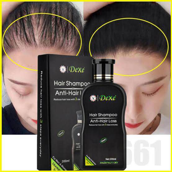 Picture of DEXE Anti-Hair Loss Hair Growth Shampoo Treatment Natural Ingredients 200ml