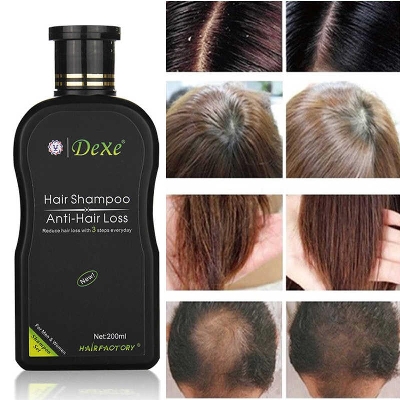 Picture of Dexe Hair Shampoo Anti hair Loss Chinese Herbal Hair Growth For Men&Women-200ml
