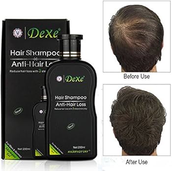 Picture of Dexe Hair Shampoo Anti hair Loss Chinese Herbal Hair Growth For Men&Women-200ml