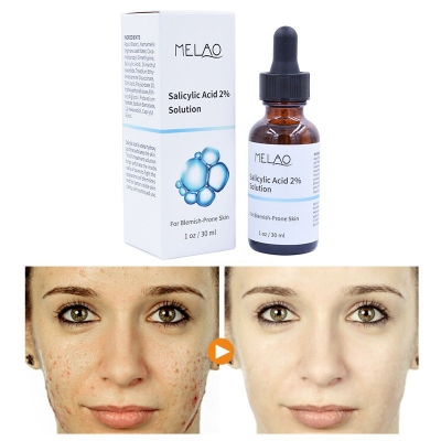 Picture of Melao Salicylic Acid 2% Solution – 30 ml