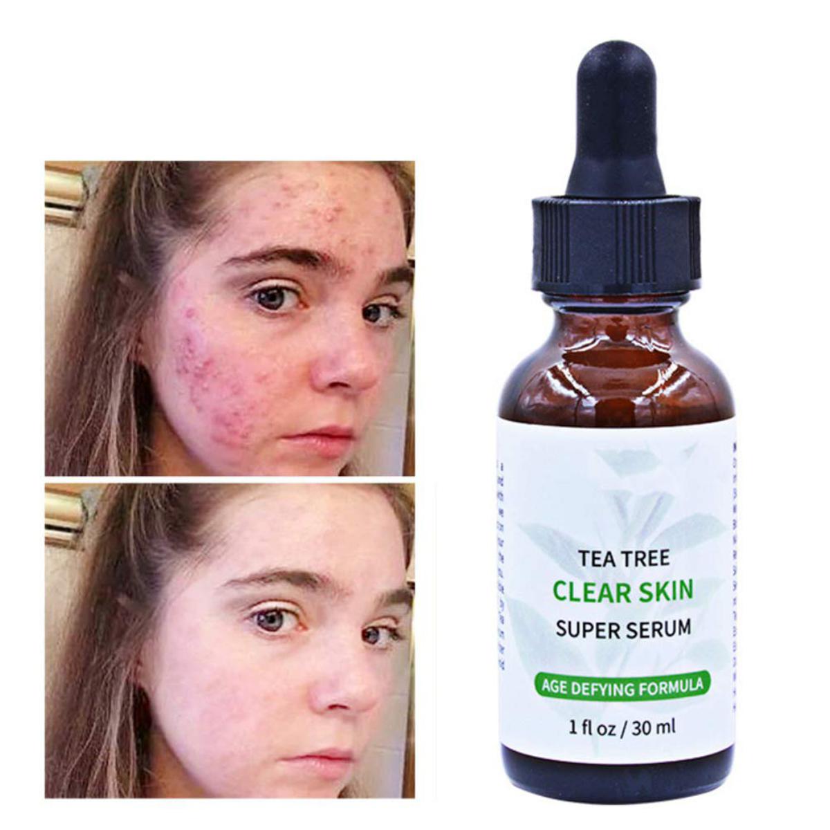Picture of MELAO TEA TREE CLEAR SKIN SUPER SERUM-30ml