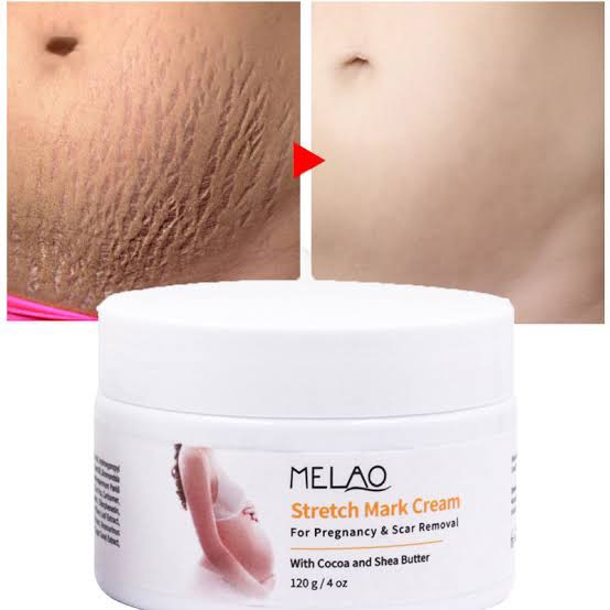Picture of Melao Stretch Mark Cream For Pregnancy And Scar Removal Treatment With Cocoa And Shea Butter Belly Moisturizer-120gm