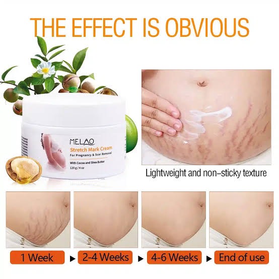Picture of Melao Stretch Mark Cream For Pregnancy And Scar Removal Treatment With Cocoa And Shea Butter Belly Moisturizer-120gm