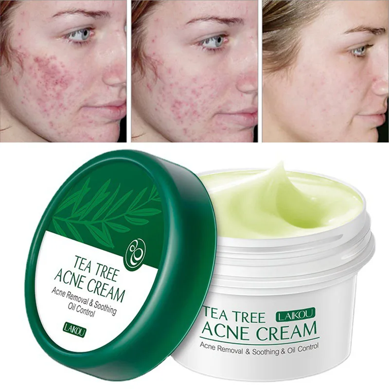 Picture of LAIKOU Tea Tree Anti-Acne Cream Effective Acne Removal Cream -20gm