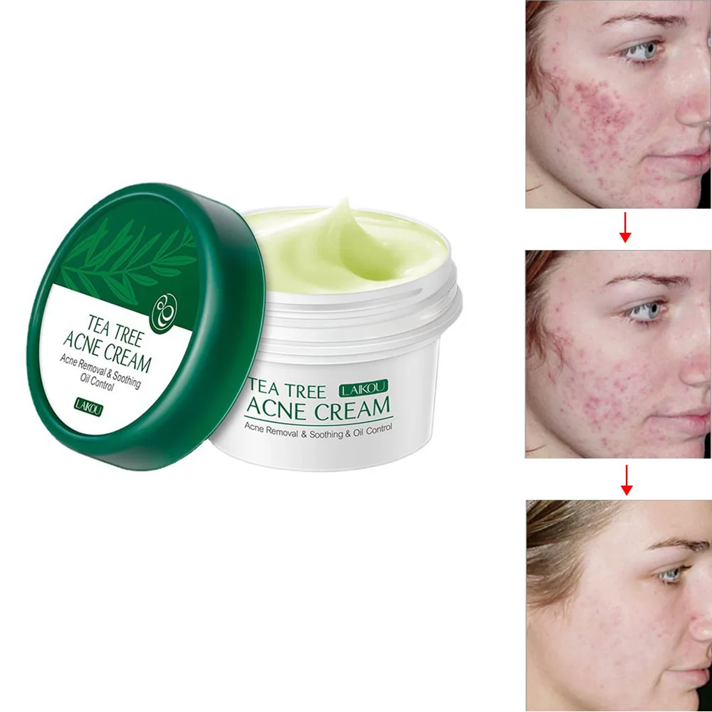 Picture of LAIKOU Tea Tree Anti-Acne Cream Effective Acne Removal Cream -20gm