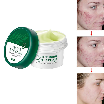 Picture of LAIKOU Tea Tree Anti-Acne Cream Effective Acne Removal Cream -20gm
