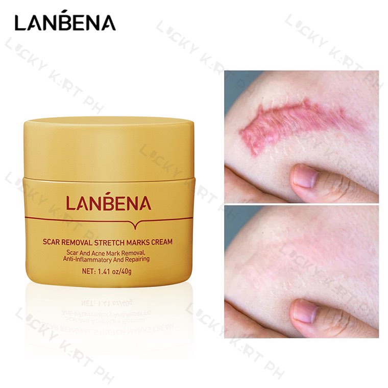 Picture of LANBENA Scar Remover Cream Repair Serum Stretch Mark Blackhead Acne Spots TCM Removal Gel Whitening Face Body Essence-40GM
