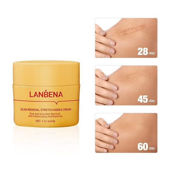 Picture of LANBENA Scar Remover Cream Repair Serum Stretch Mark Blackhead Acne Spots TCM Removal Gel Whitening Face Body Essence-40GM