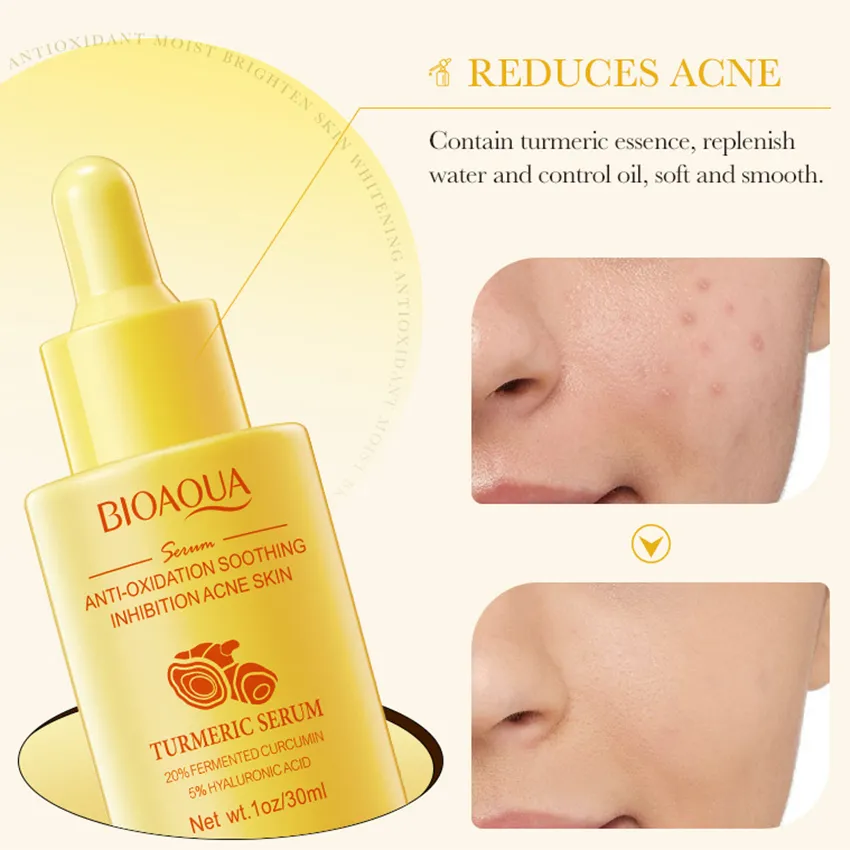 Picture of BIOAQUA Turmeric Essence Brightening Acne Relieving Serum – 30ml
