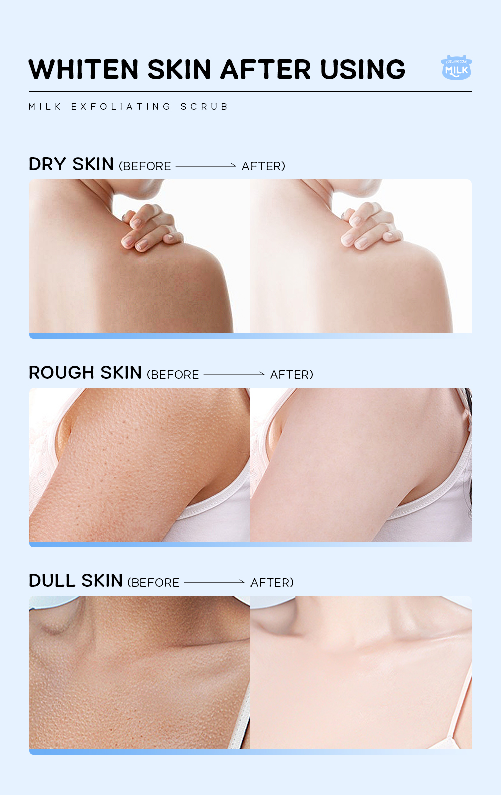 Picture of LAIKOU Milk Exfoliating Body Scrub Remove Cuticle Dead Skin Smoothing Even Skin Tone -90gm