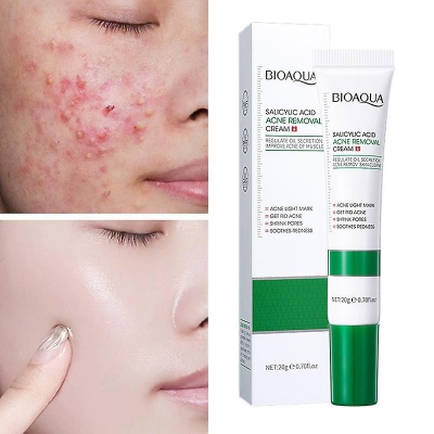 Picture of BIOAQUA Acne Removal Cream Anti Acne Treatment Repair Marks Moisturizing Blackhead Remover Facial Cream Skin Care-20gm