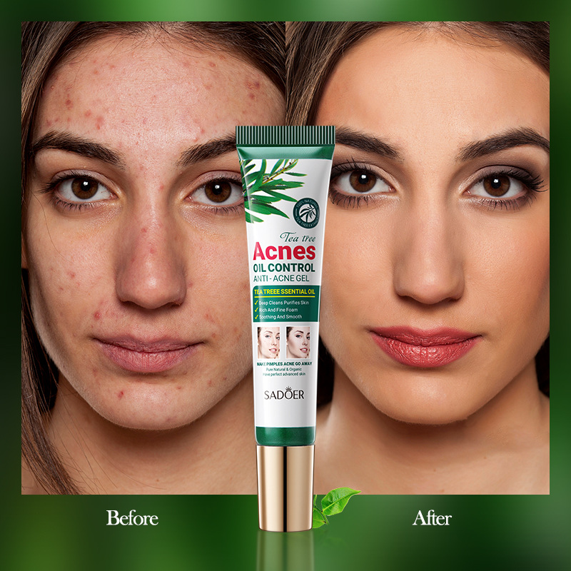 Picture of SADOER Tea Tree Acne Oil Control Face Gel Anti-Acne Hydrating Moisturizing Gel 20g