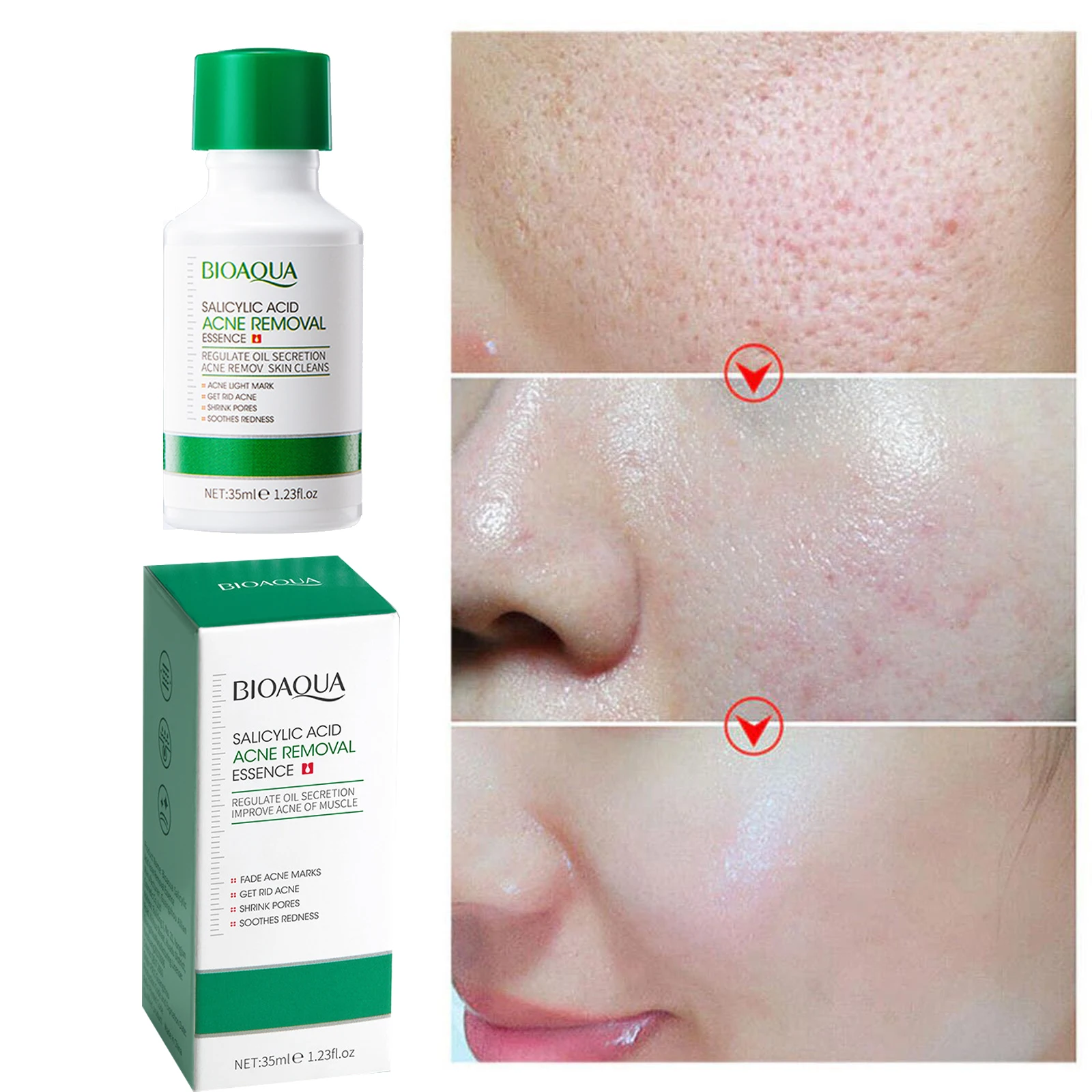 Picture of BIOAQUA Salicylic Acid Shrink Pores Face Serum Oil Control Remove Acne Blackheads Dark Spot Whitening Moisturizing Skin Care Essence -35ML