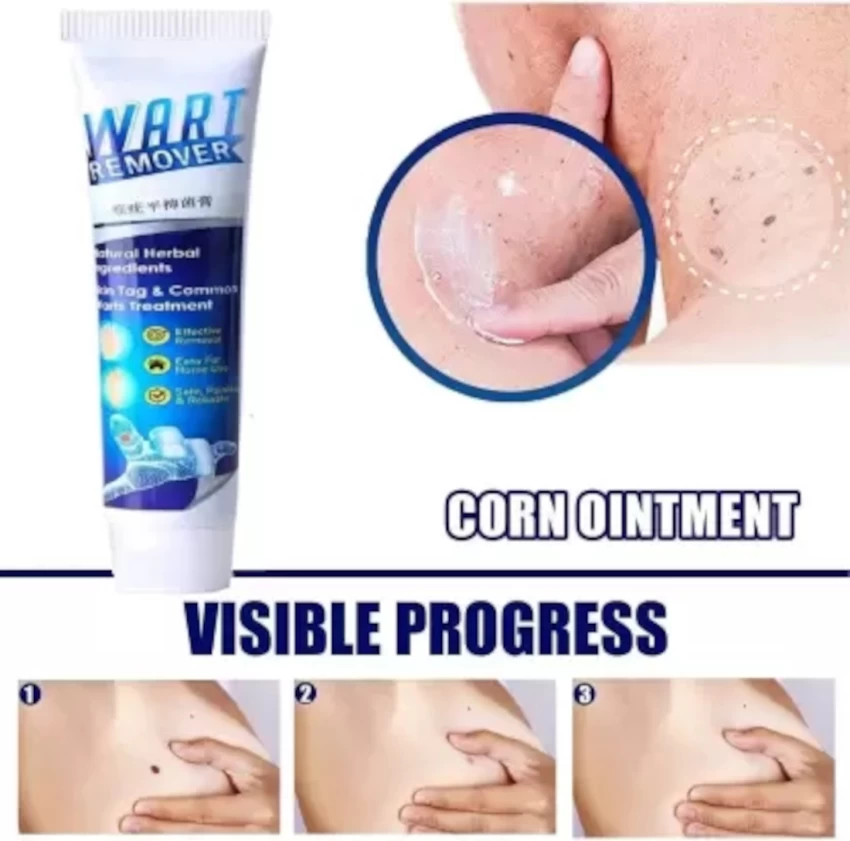 Picture of Warts Remover Ointment Wart Treatment Cream Skin Tag Remover Ointment-20gm