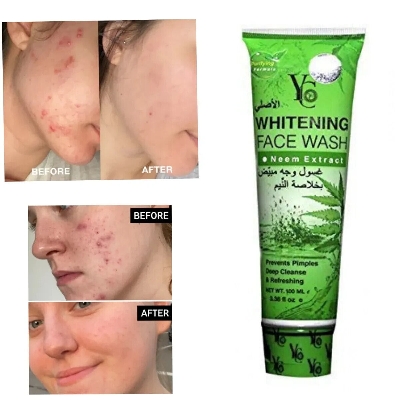 Picture of YC Whitening Neem Extract Acne Face Wash for Unisex - Prevent Pimples deep cleanse & Refreshing (100 ML)