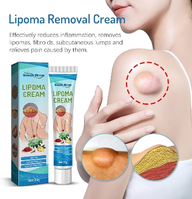 Picture of South Moon Lipoma Removal Cream Lipolysis Fat Lump Relieve Plaster Skin Swelling Ointment Subcutaneous Lumps Dredge Dissipate Body Care（20g）