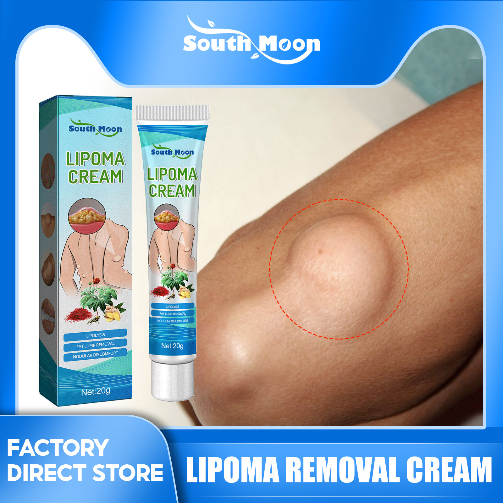 Picture of South Moon Lipoma Removal Cream Lipolysis Fat Lump Relieve Plaster Skin Swelling Ointment Subcutaneous Lumps Dredge Dissipate Body Care（20g）