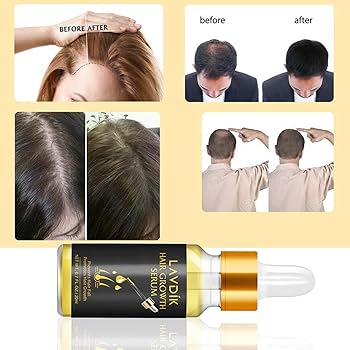 Picture of Eelhoe Hair Essential Oil for Scalp & Hair Care-20gm