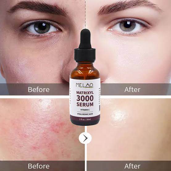 Picture of Melao Face Serum Organic Pure Anti Aging & Wrinkles Nourishing Deep Cleansing Matrixyl 3000 Serum-30ml