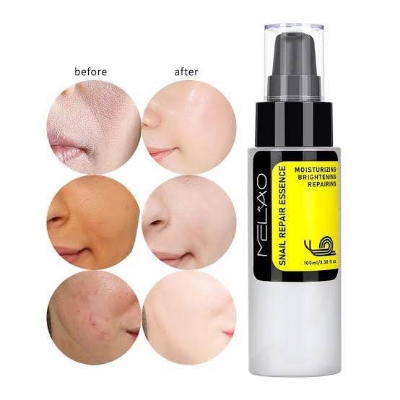 Picture of •MELAO Snail Serum Hyaluronic Acid Essence Face Cream Moisturizing Acne Treatment Skin Care Repair Whitening Anti-Aging-100ml