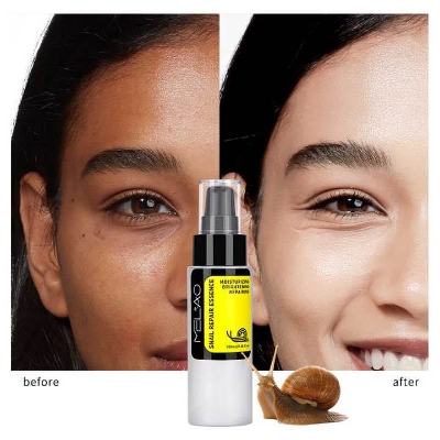 Picture of •MELAO Snail Serum Hyaluronic Acid Essence Face Cream Moisturizing Acne Treatment Skin Care Repair Whitening Anti-Aging-100ml