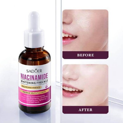 Picture of SADOER Niacinamide Skin Whitening Face Serum for Shrink Pores, Dark Spots and Freckles serum-30ml