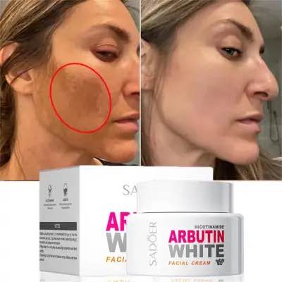 Picture of Sadoer Arbutin Nicotinamide Whitening Facial Cream -50gm