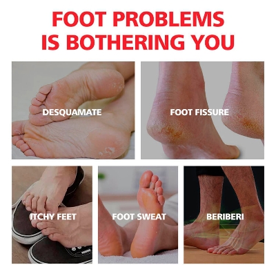 Picture of Aichun Beauty Foot Cream Balm For Cracked Heel Dead Skin Remover Foot Cream Anti-Crack Deep Moisturizing Foot Cream-20gm