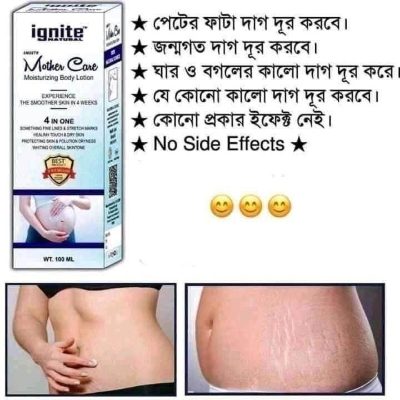 Picture of ignite natural Moisturizing Skin Lotion Smoothe-Mother`s Care 250ml