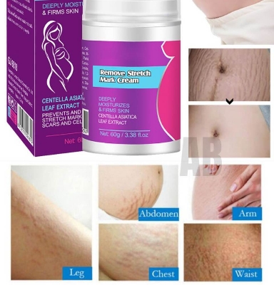 Picture of Guanjing Remove Stretch Mark Cream 60gm Deeply Moisturizes & Firms Skin Prevents and Reduces Scars and Cellulite