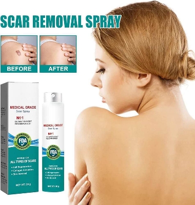 Picture of South Moon Medical Grade Scar Spray, Scar Remove Medical Grade Scar Spray-20gm