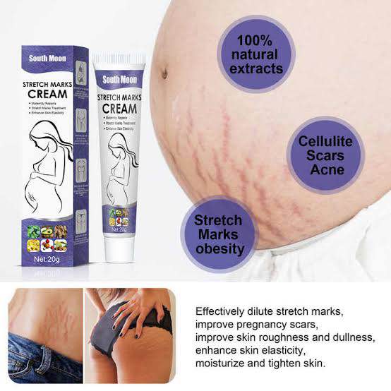 Picture of South Moon Effective Body Stretch Marks Removal Cream Lotion Pregnancy Stretch Mark Cream for Fair Skin Repair Cream 20g
