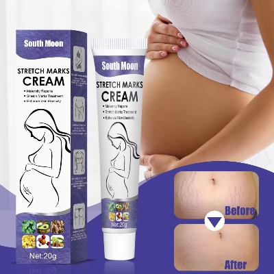 Picture of South Moon Effective Body Stretch Marks Removal Cream Lotion Pregnancy Stretch Mark Cream for Fair Skin Repair Cream 20g